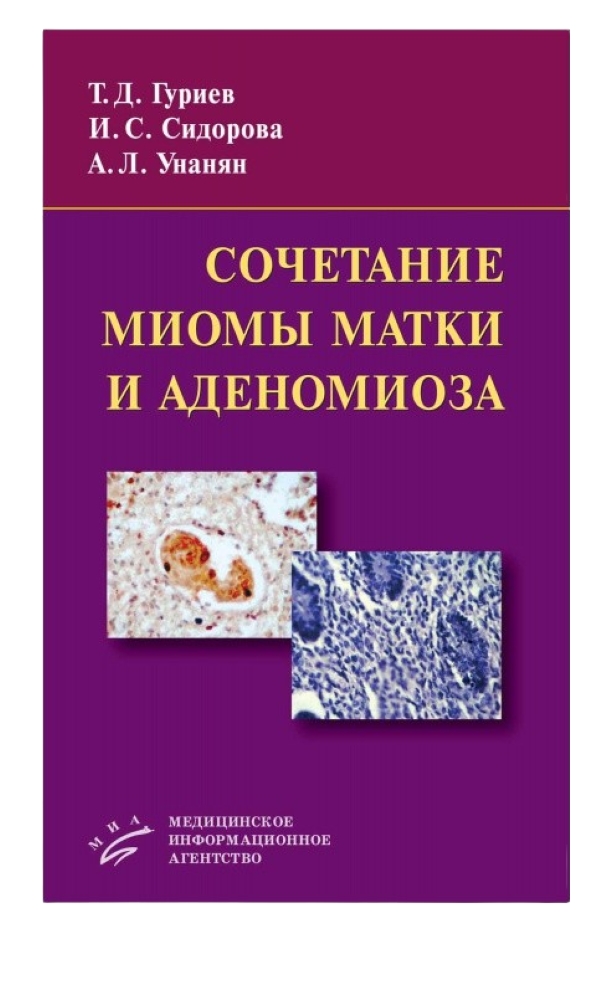 фото Книга сочетание миомы матки и аденомиоза / гуриев т.д., сидорова и.с., унанян а.л. миа