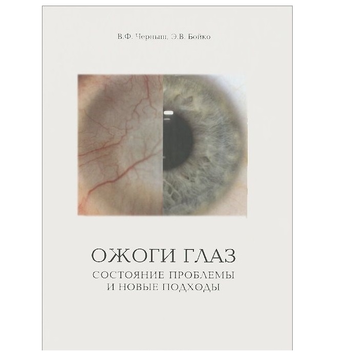 

Книга Ожоги глаз – состояние проблемы и новые подходы Производитель: Ожоги глаз – состо...