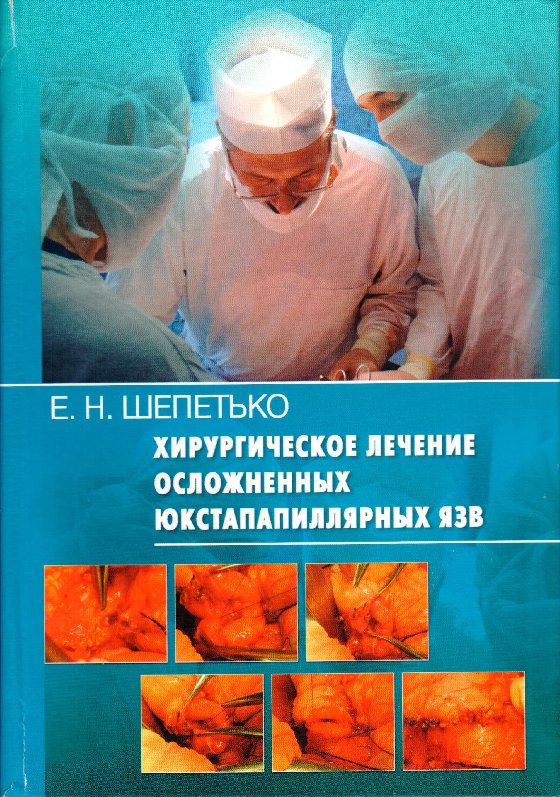 

Хирургическое лечение осложненных юкстапапиллярных язв. / Шепетько