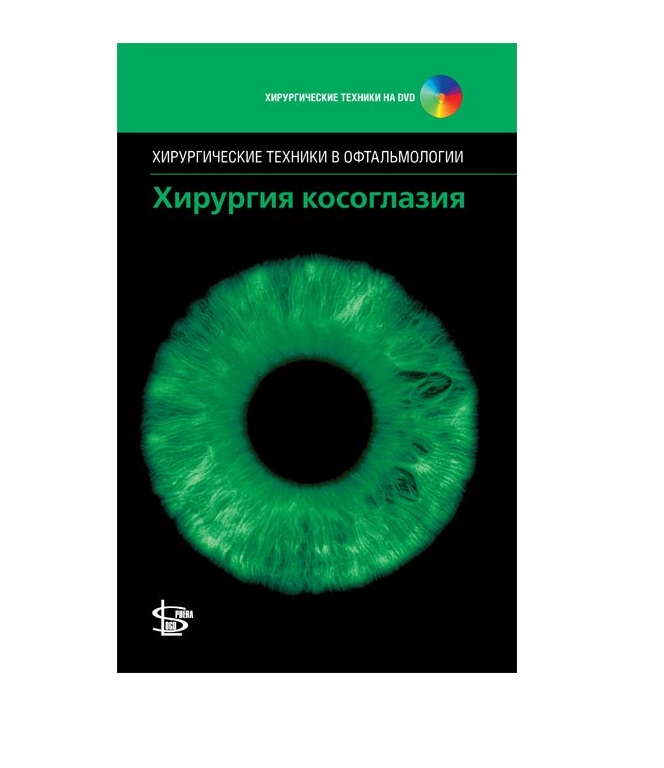 фото Книга хирургия косоглазия + cd (серия хирургические техники в офтальмологии ) / джон д.... логосфера