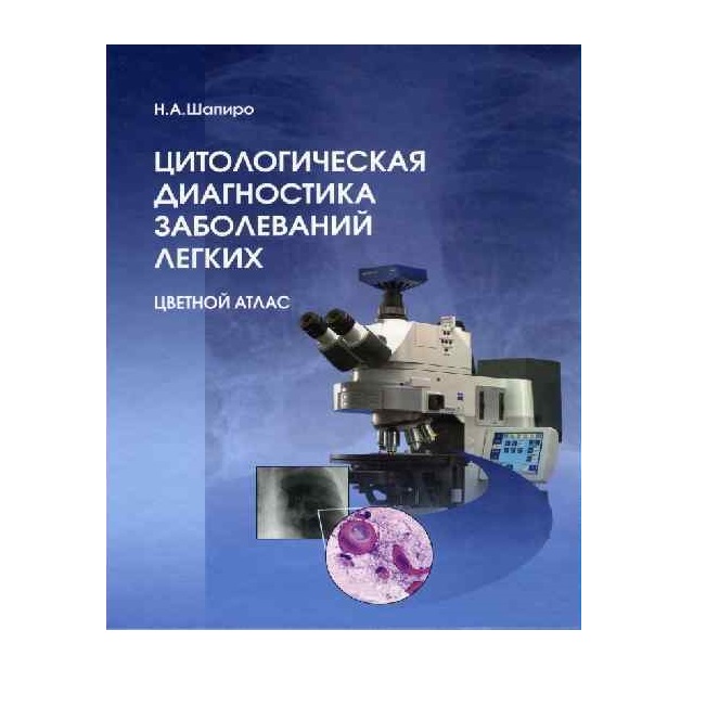 

Цитологическая диагностика опухолей костей под редакцией Шапиро Н.А., Полонской Н.Ю.