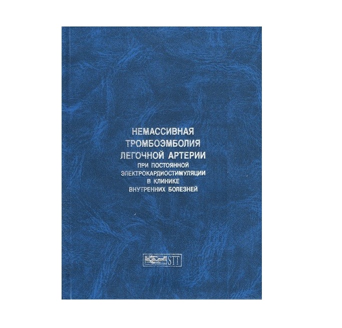 

Немассивная тромбоэмболия легочной артерии при постоянной электрокардиостимуляции...