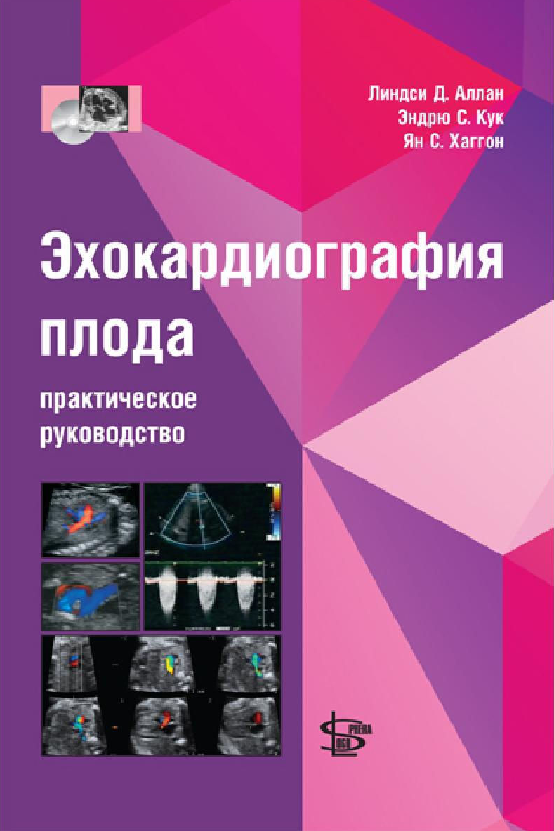 фото Книга эхокардиография плода: пр. рук-во +cd / аллан л.д. логосфера