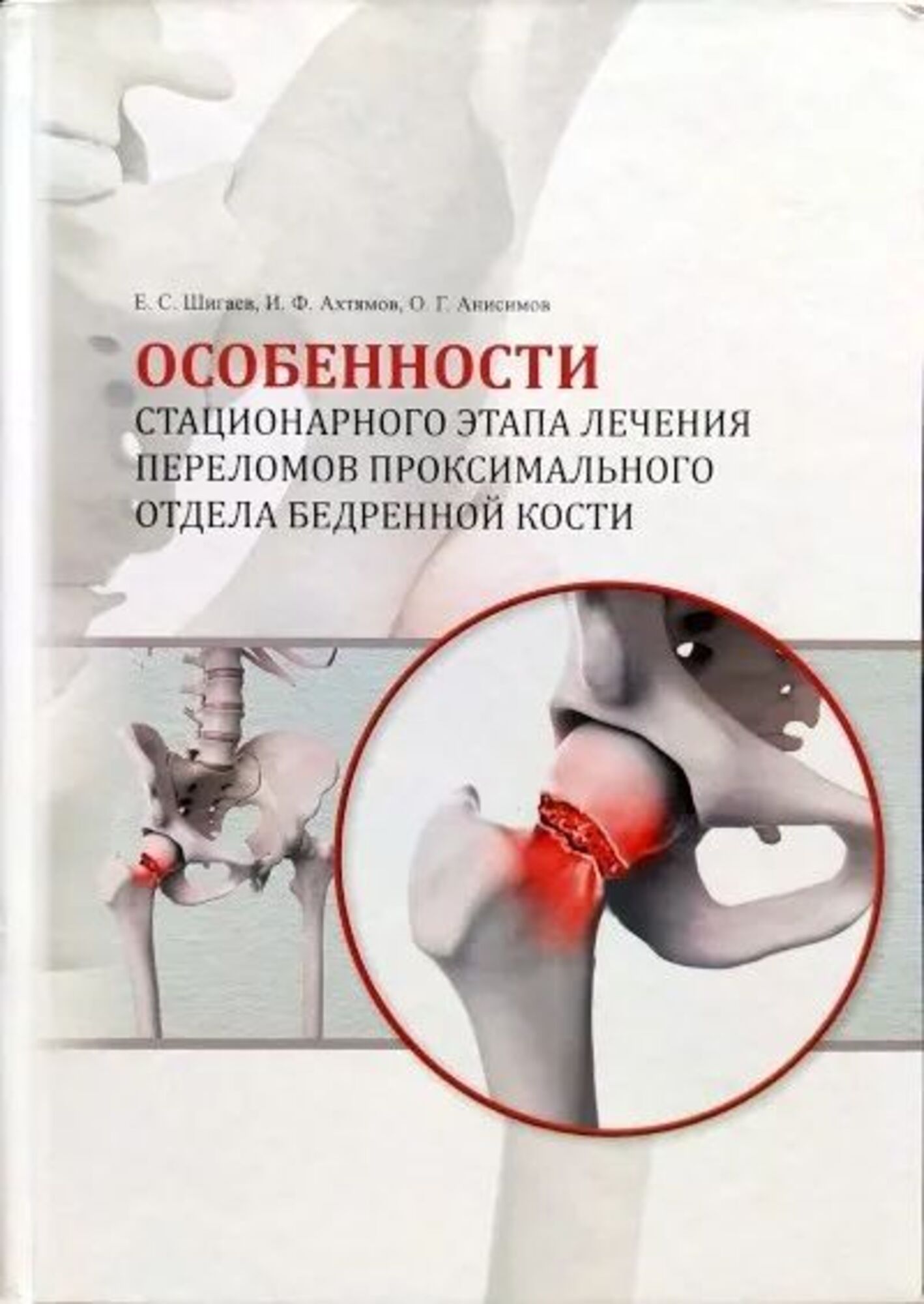 

Особенности стационарного этапа лечения переломов проксимального отдела бедренной...