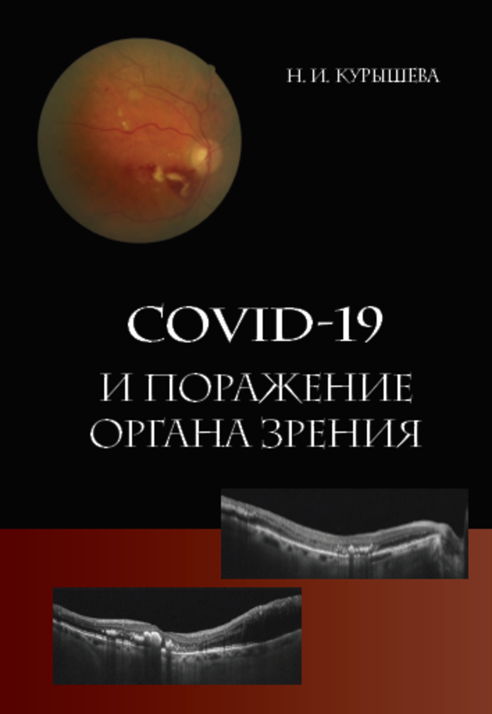

COVID-19 и поражение органа зрения. Монография / Курышева Н.И.