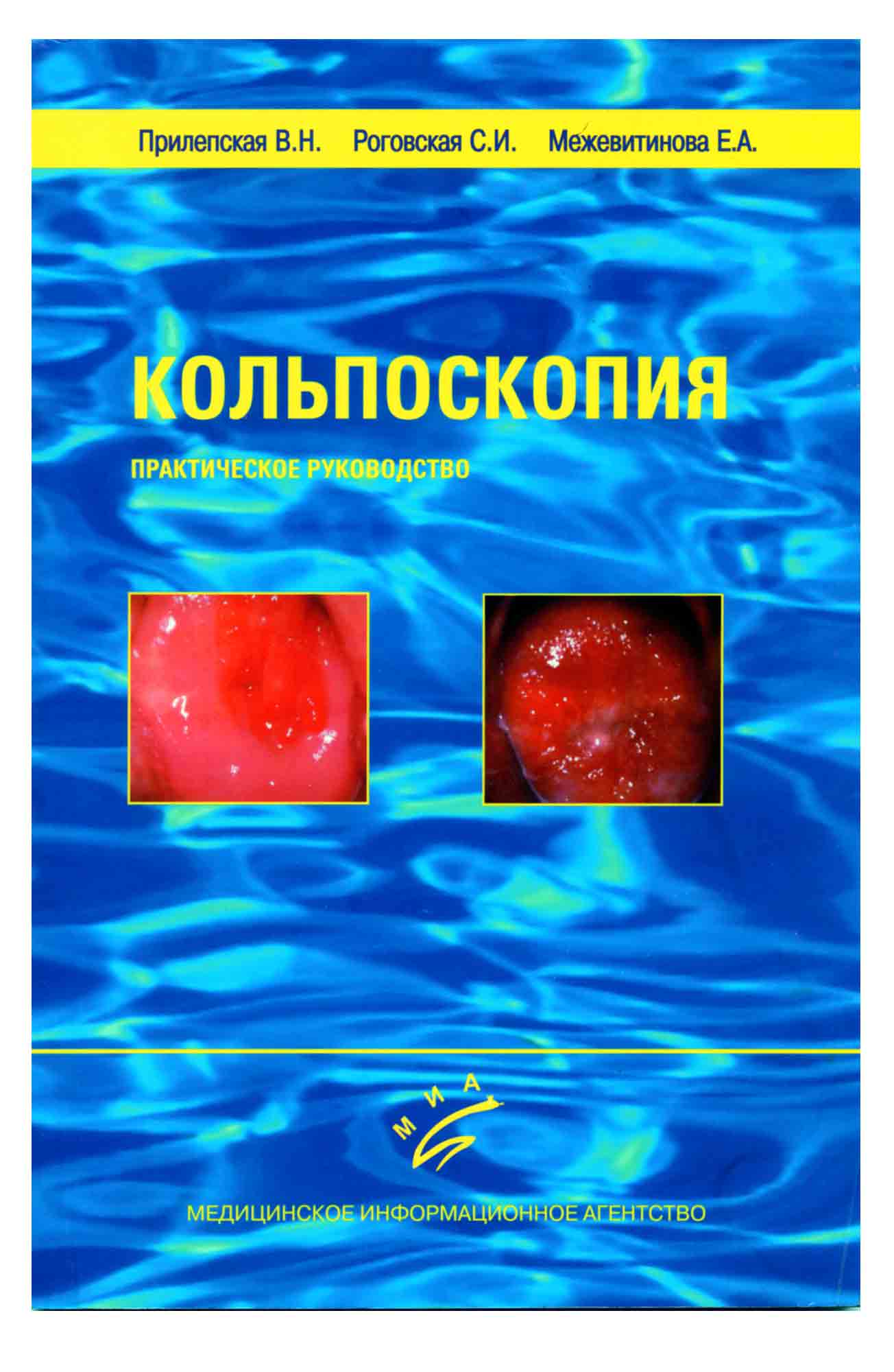 

Книга Кольпоскопия. Практическое руководство / Прилепская В.Н