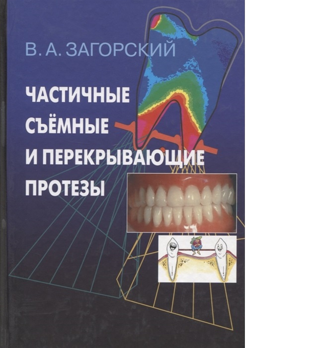 фото Книга частичные съемные и перекрывающие протезы / загорский медицина