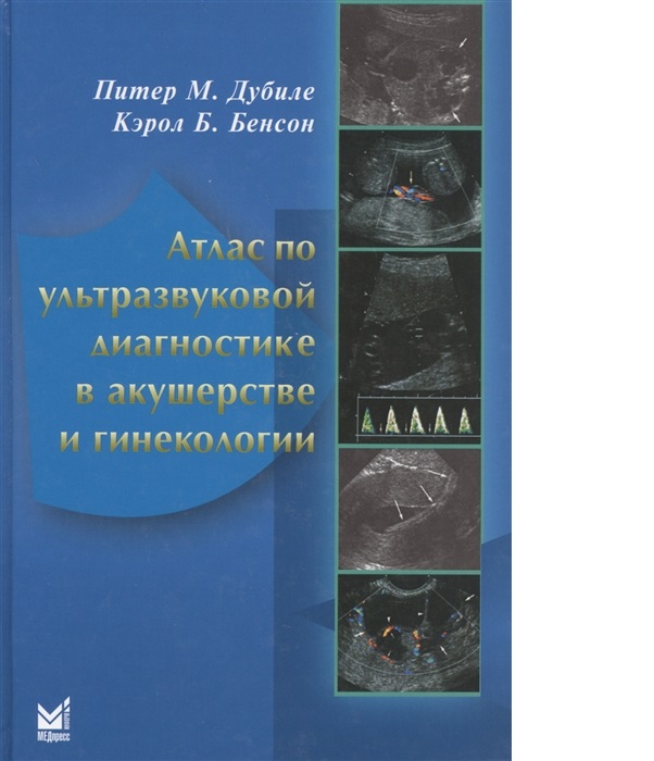 Книга Атлас по УЗД в акушерстве и гинекологии / Дубиле