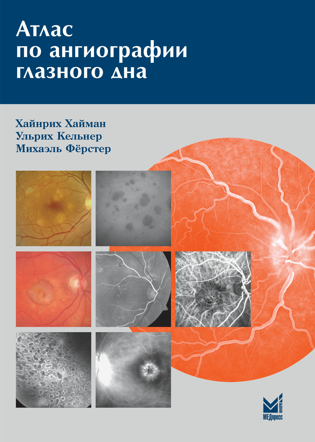 фото Книга атлас по ангиографии глазного дна / хайман х., кельнер у., фёрштер м. медпресс