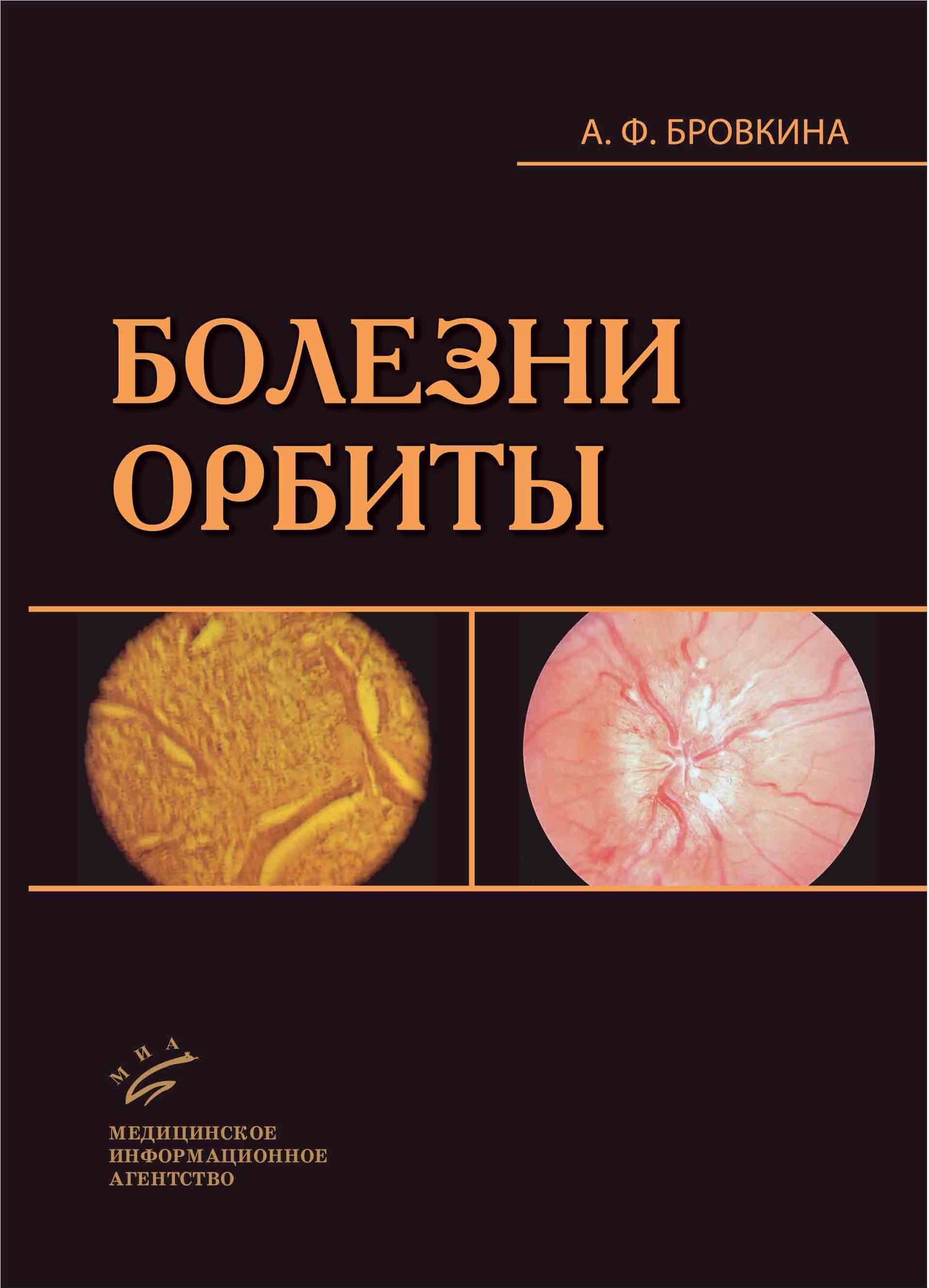 

Книга Болезни орбиты 2-е изд. доп. и перераб. / Бровкина А.Ф