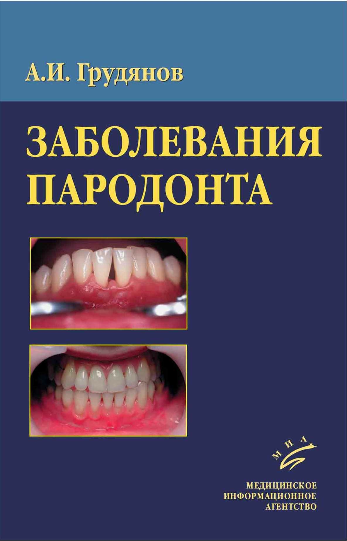 

Книга Заболевания пародонта, гриф УМО / Грудянов А.И