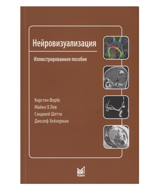 фото Книга нейровизуализация: краткое иллюстрированное пособие / форбс к., лев м.х., шетти с... медпресс