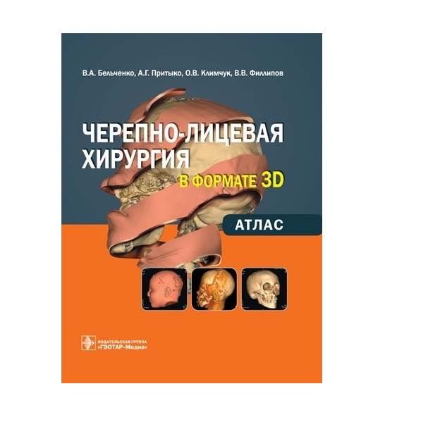 

Книга Черепно-лицевая хирургия в формате 3D: Атлас / Бельченко В.А., Притыко А.Г., Клим...