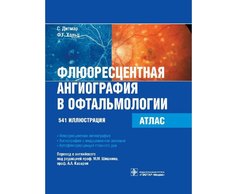 

Книга Флюоресцентная ангиография в офтальмологии. Атлас / Дитмар С., Хольц Ф.Г. Перевод...