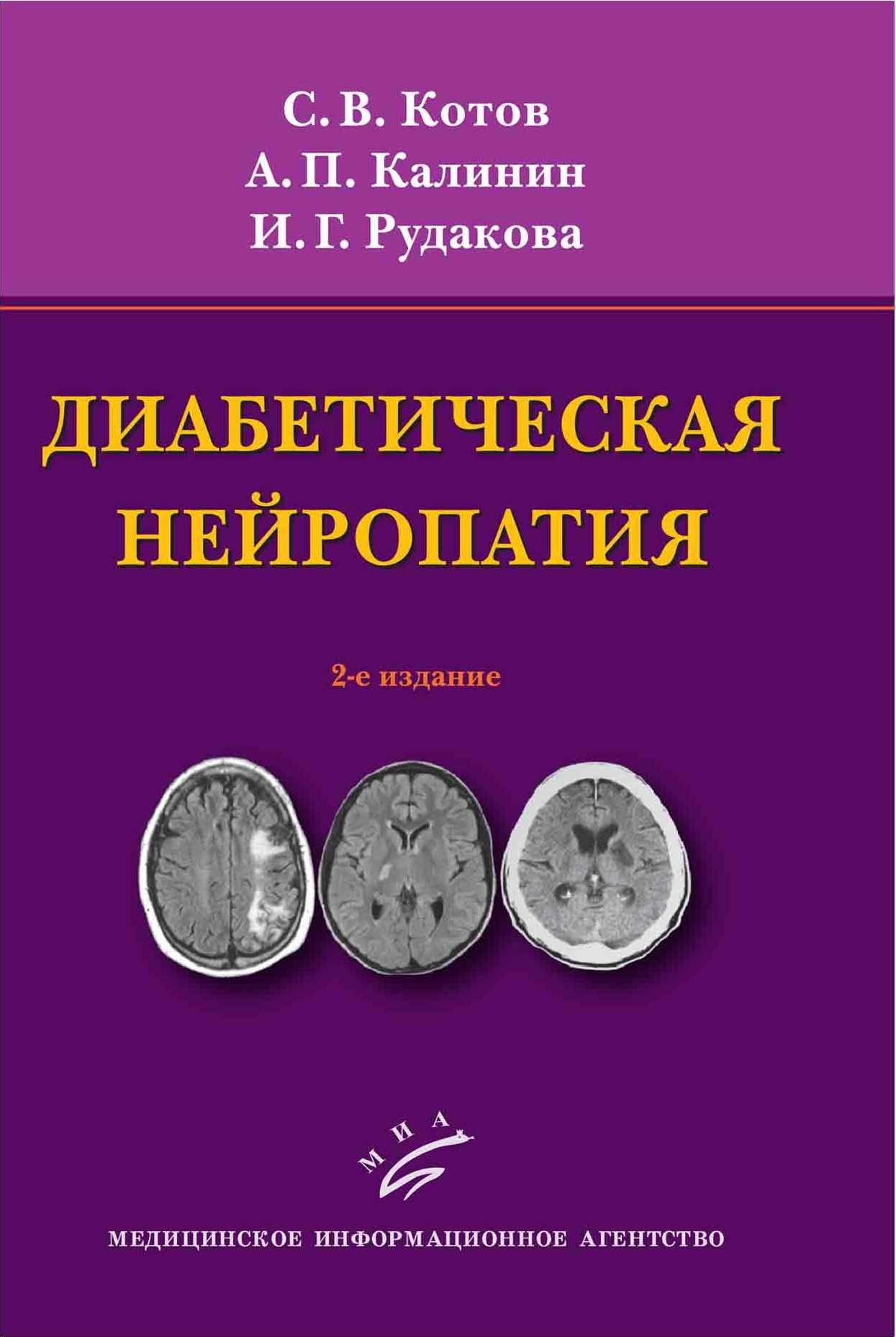 

Книга Диабетическая нейропатия. - 2-е изд., перераб. и доп. (иллюстрации) / Котов С.В.,...