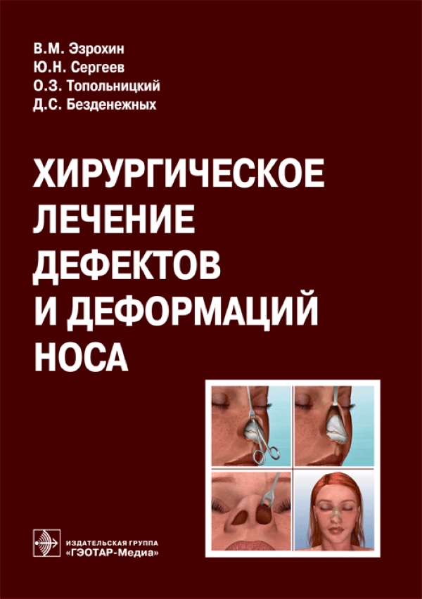 

Хирургическое лечение дефектов и деформаций носа / Эзрохин В.М. и др.