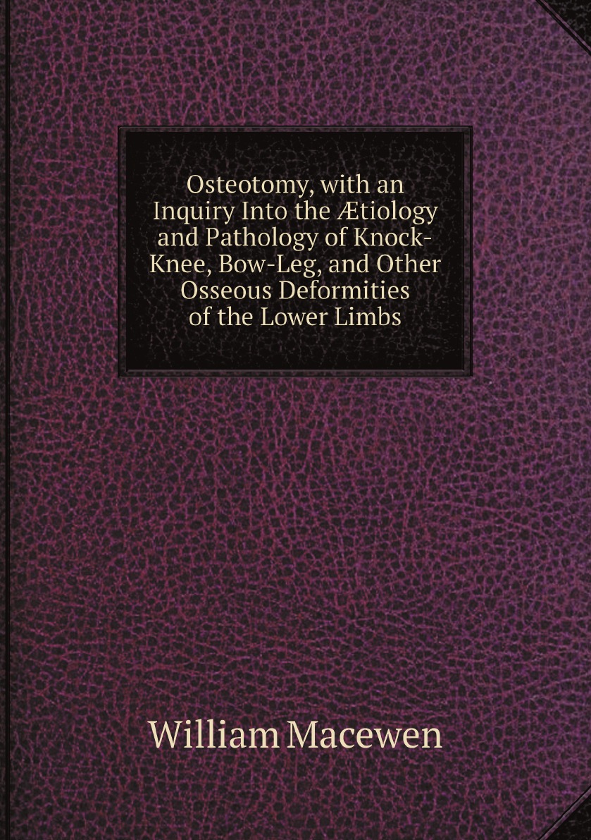 

Osteotomy, with an Inquiry Into the tiology and Pathology of Knock-Knee, Bow-Leg