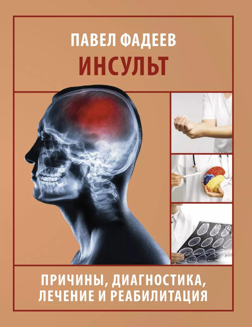 

Инсульт: причины, диагностика, лечение и реабилитация