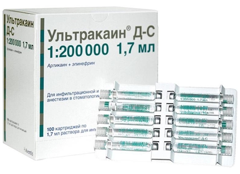 

Ультракаин Д-С картр. 1,7 мл 100 шт., Ультракаин