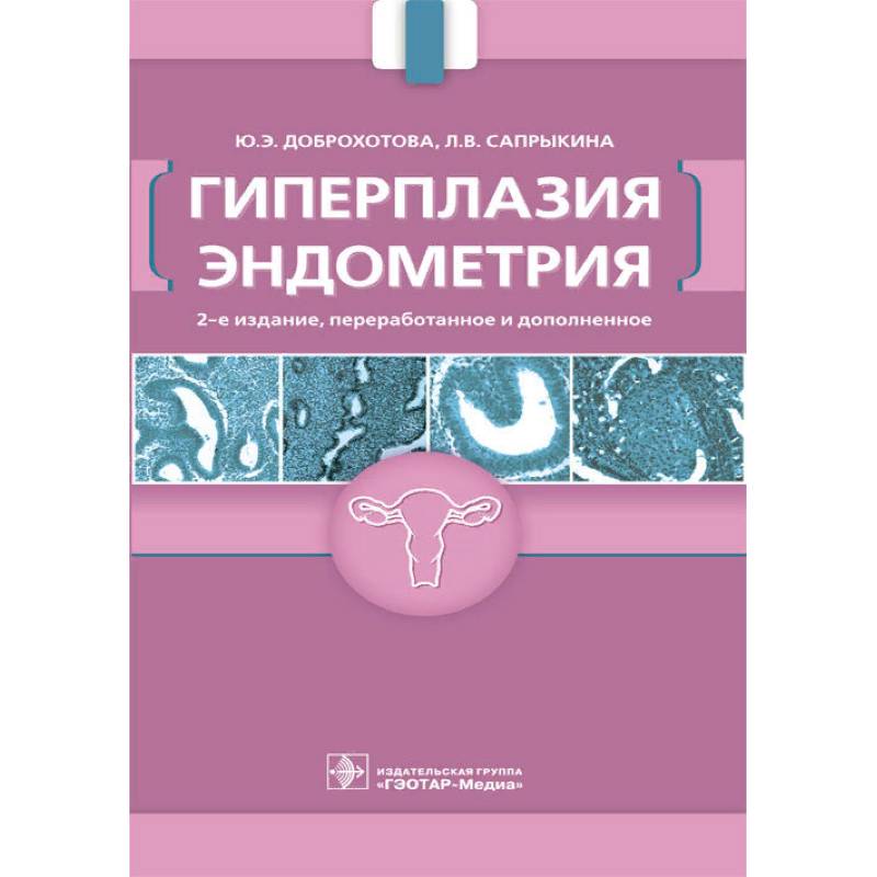 

Гиперплазия эндометрия 2-е издание Доброхотова, Сапрыкина
