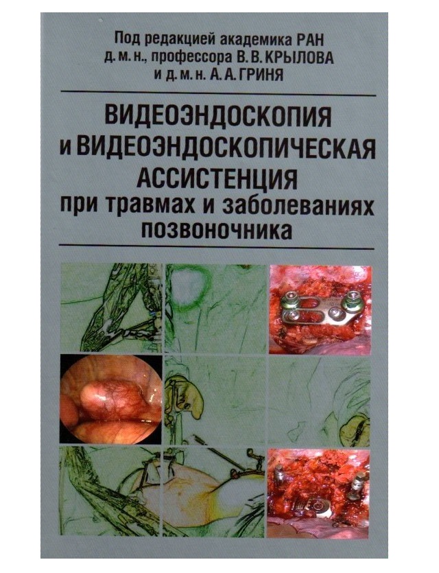 

Книга Видеоэндоскопия и видеоэндоскопическая ассистенция при травмах и заболеваниях поз...