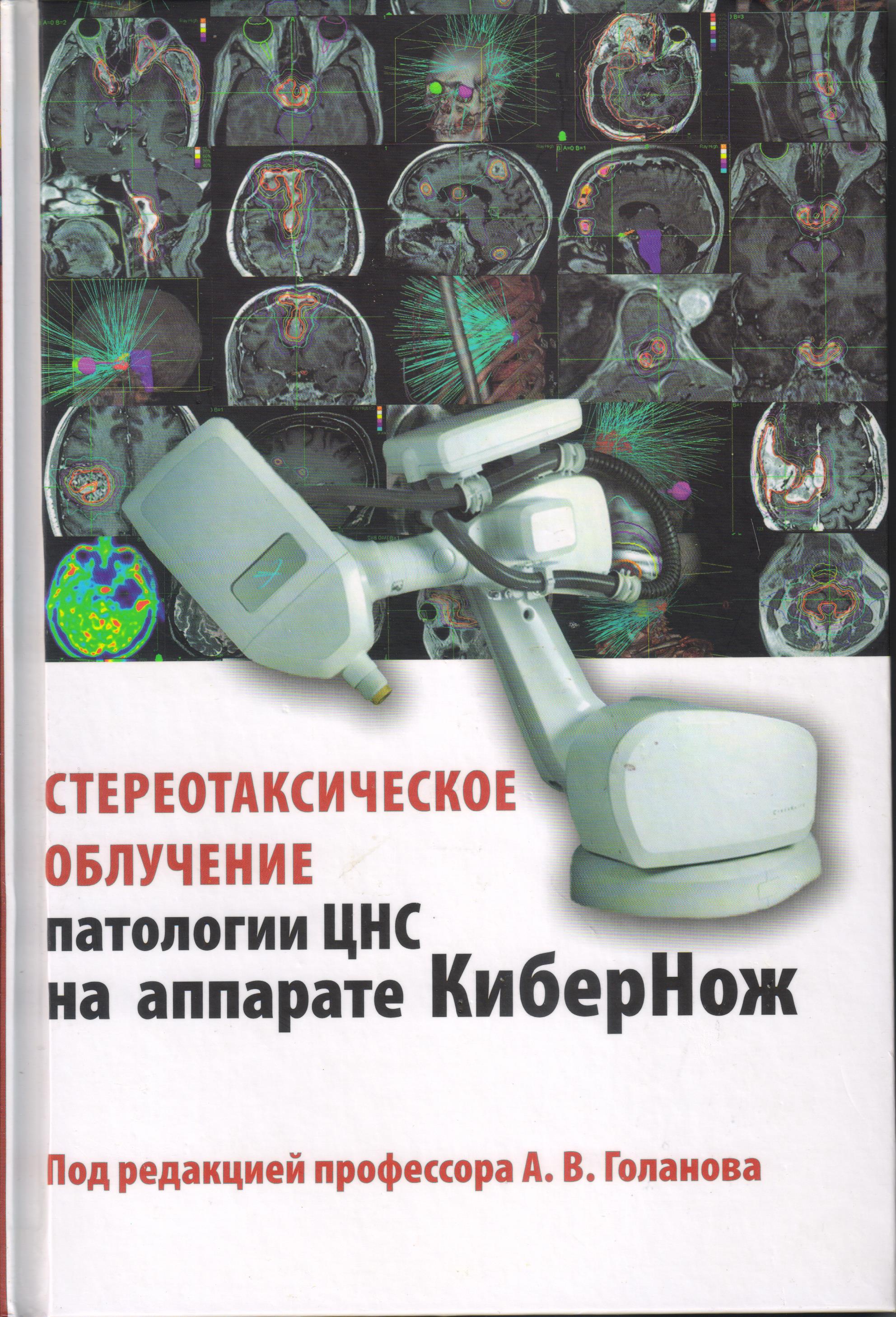 Стереотаксическое облучение. Книги по лучевой терапии. Книга по стереотаксическому облучению. Голан литература. Лучевая терапия Белгород.