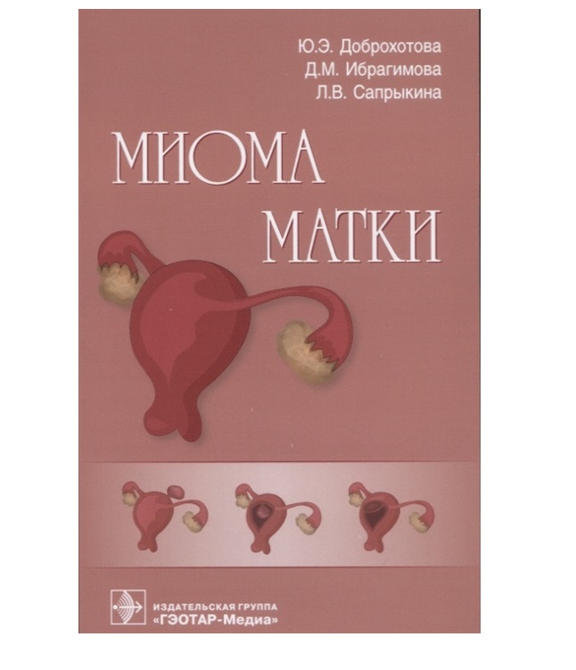 

Миома матки Доброхотова Ю.Э., Ибрагимова Д.М., Сапрыкина Л.В.