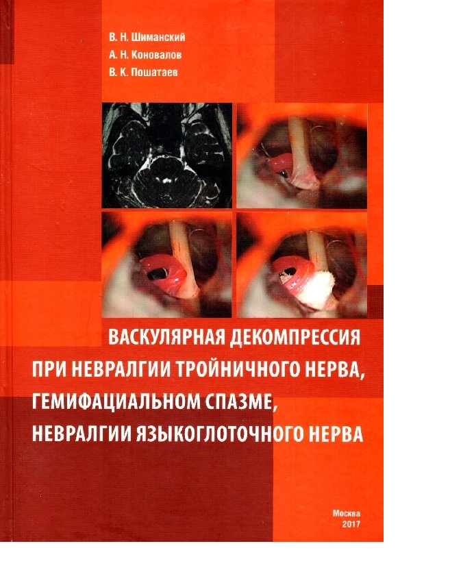 

Книга Васкулярная декомпрессия при невралгии тройничного нерва, гемифациальном спазме, ...