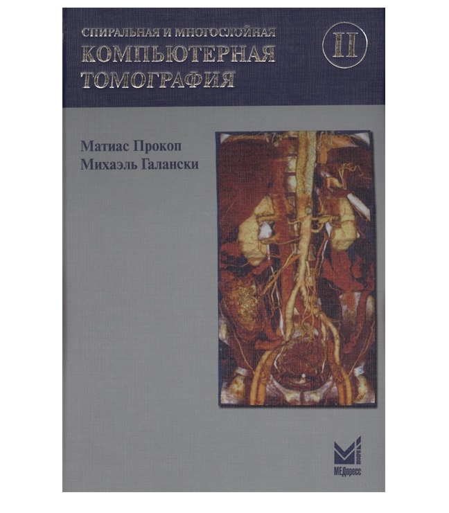 

Спиральная и многослойная КТ Т.2 / Прокоп М., Галански М.