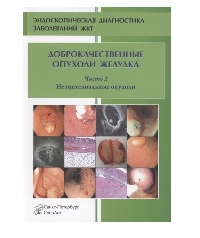 

Доброкачественные опухоли желудка.Часть 2 Неэпителиальные / Кузин М.Н.