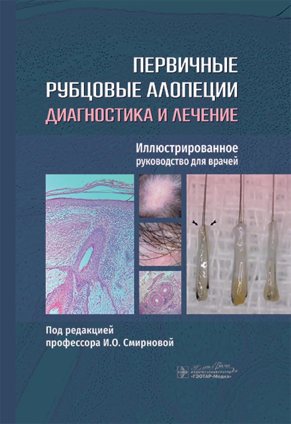 

Первичные рубцовые алопеции: диагностика и лечение