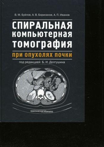 фото Спиральная компьютерная томография при опухолях почки практическая медицина