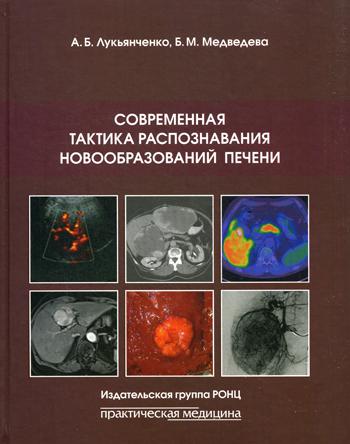 фото Книга современная тактика распознавания новообразований печени практическая медицина