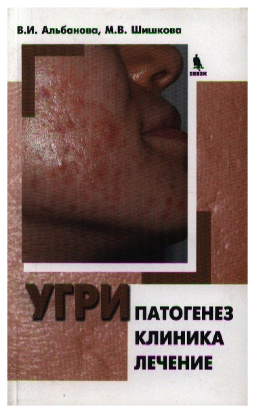 

Угри. Патогенез. Клиника. Лечение