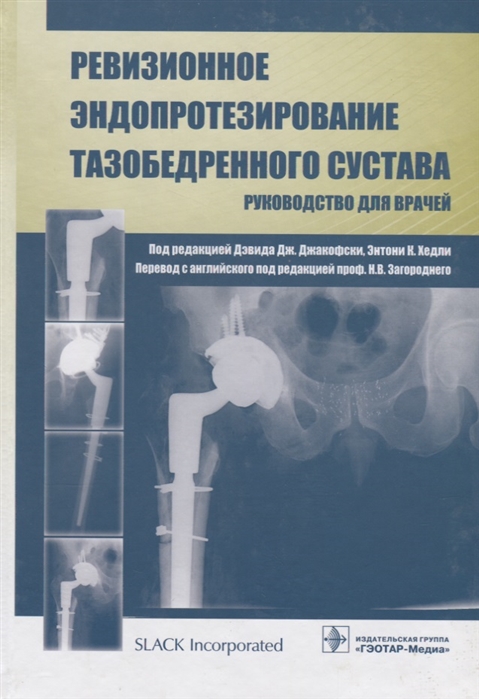 

Книга Ревизионное Эндопротезирование тазобедренного Сустава. Руководство для Врачей