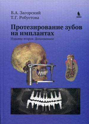 

Протезирование Зубов на Имплантах. Руководство