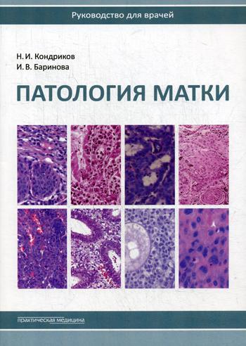 фото Книга патология матки практическая медицина