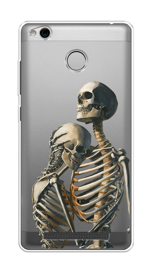 

Чехол на Xiaomi Redmi 3 Pro (3S) "I’m so sorry", Серый;бежевый;черный, 30950-4