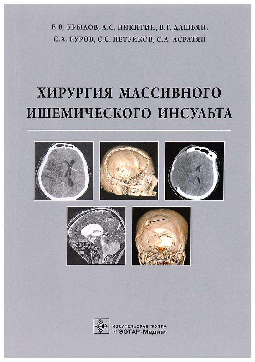 

Книга Хирургия Массивного Ишемического Инсульта