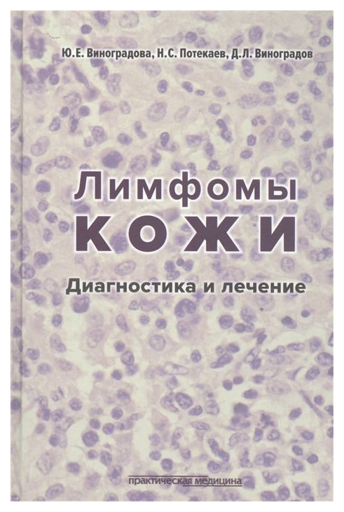 фото Лимфомы кожи: диагностика и лечение практическая медицина