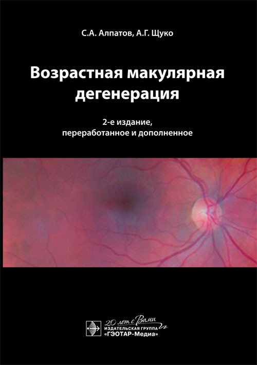 

Возрастная Макулярная Дегенерация