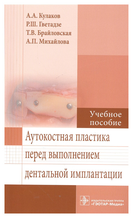 

Аутокостная пластика перед Выполнением Дентальной Имплантации