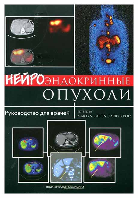 фото Книга нейроэндокринные опухоли практическая медицина