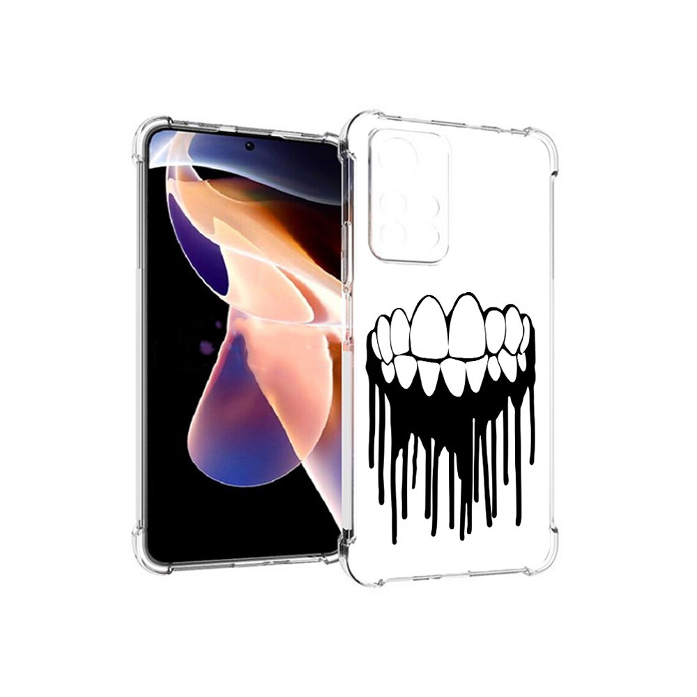 Чехол MyPads Tocco для Xiaomi Redmi Note 11 Pro зубы (PT224811.282.372)