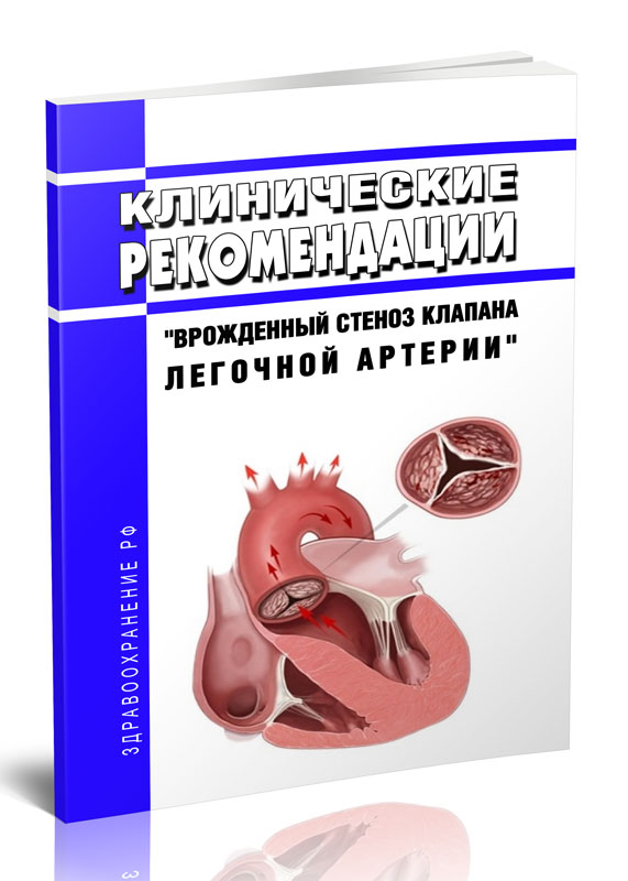

Клинические рекомендации "Врожденный стеноз клапана легочной артерии" (Дети)