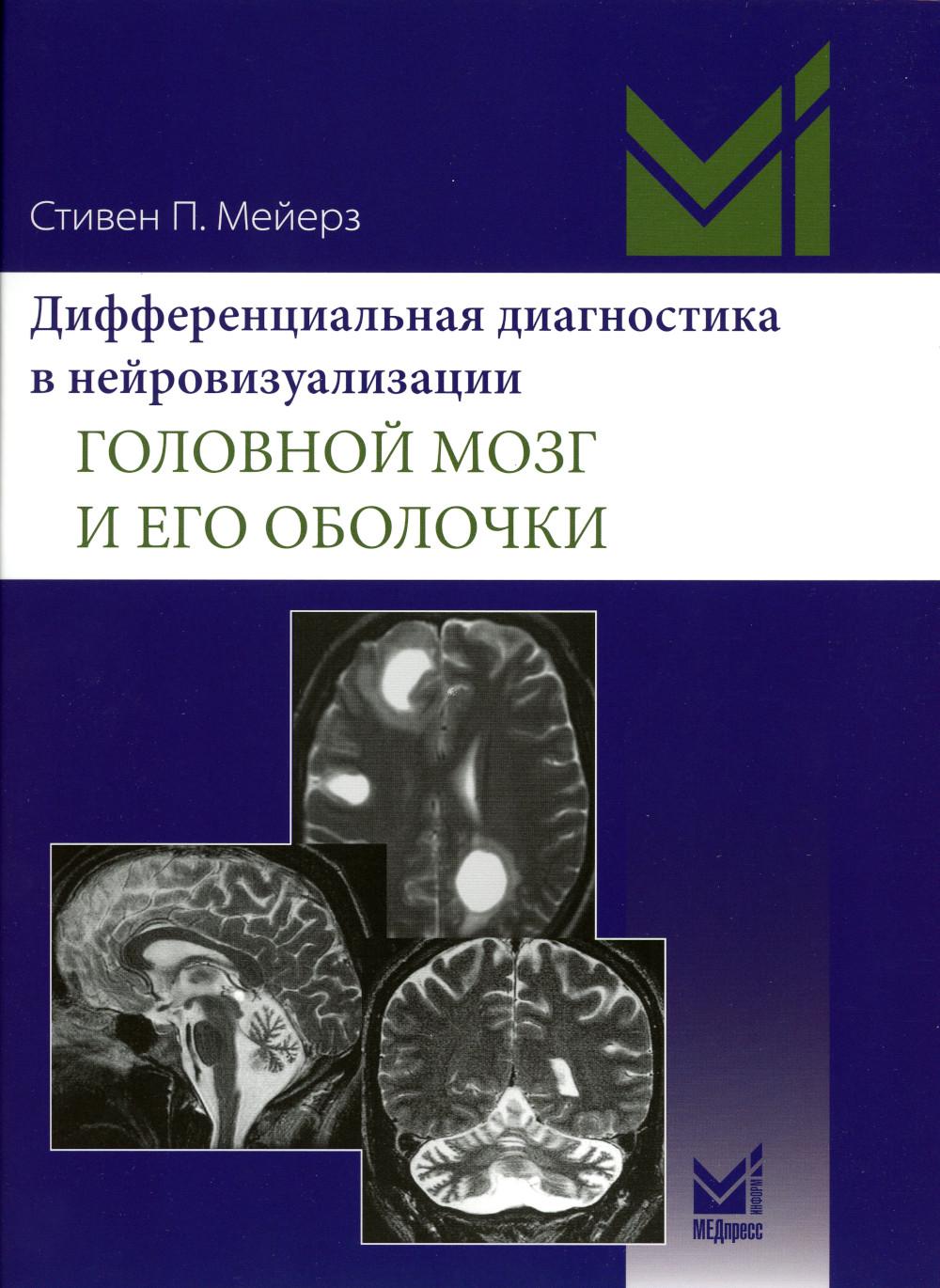 

Дифференциальная диагностика в нейровизуализации. Головной мозг и его оболочки