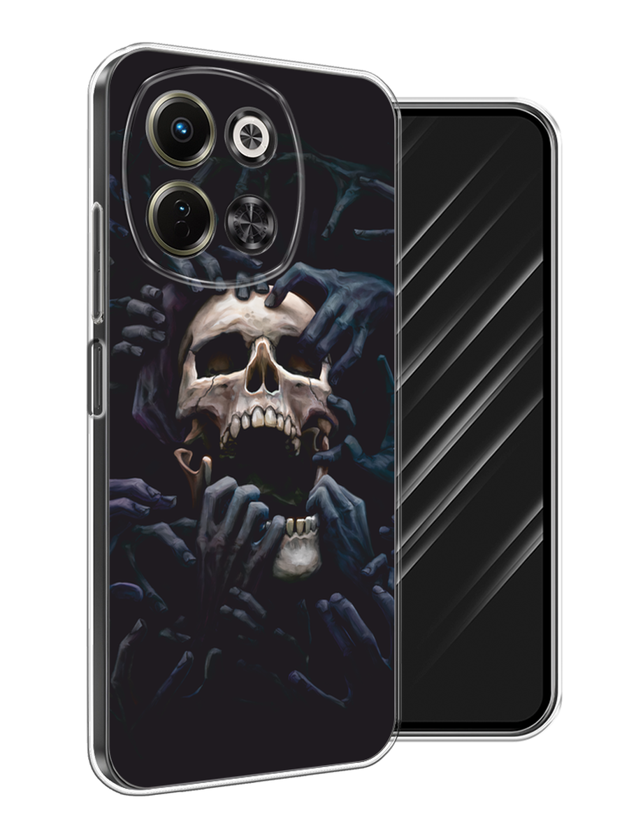 

Чехол Awog на Tecno Spark 30 5G "Череп 29", Черный;серый, 309750-1