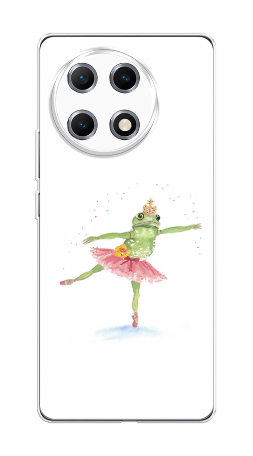 

Чехол на Tecno Camon 30S Лягушка-балерина, Зеленый, 309650-1