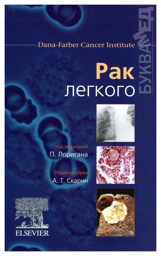 

Рак легкого