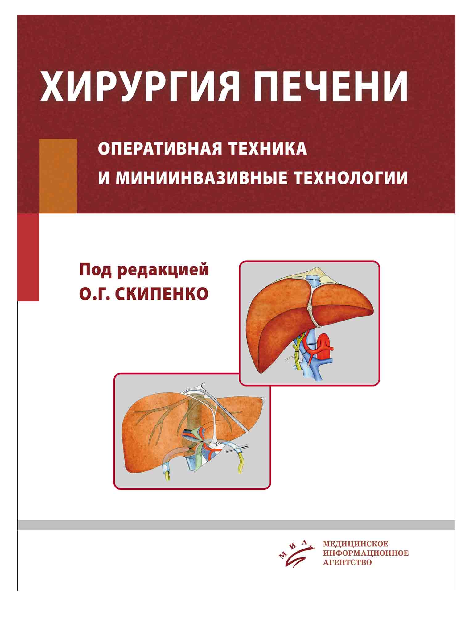 

Хирургия печен и Оперативная техника и Миниинвазивные технологи и Руководство для...